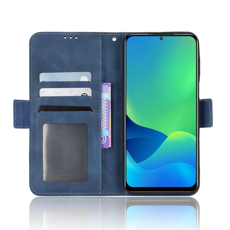 For Ulefone Note 13P Skin Feel Calf Pattern Leather Phone Case(Blue)