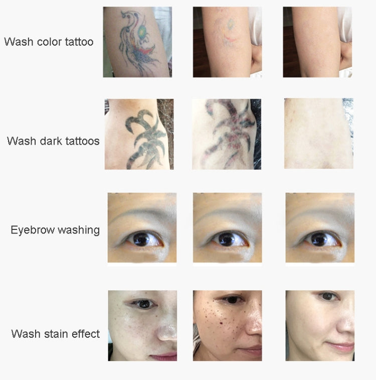 Laser Tattoo Removal Machine Non-invasive Eyebrow Washing Beauty Equipment(EU Plug) - Beauty Instrument by PMC TechLife | Online Shopping South Africa | PMC TechLife