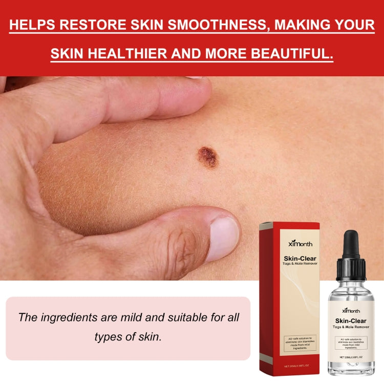 Ximonth 20ml/Bottle Anti Mole And Wart Liquid Dark Spot Tag Remover Skin Essence - free shipping - PMC Jewellery - Order now!