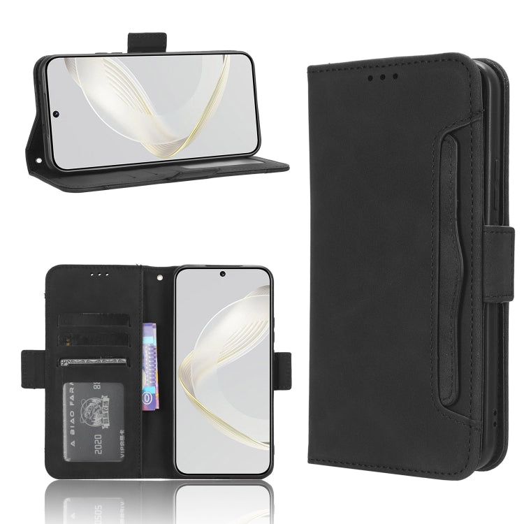 For Huawei nova 11 Skin Feel Calf Texture Card Slots Leather Phone Case(Black)