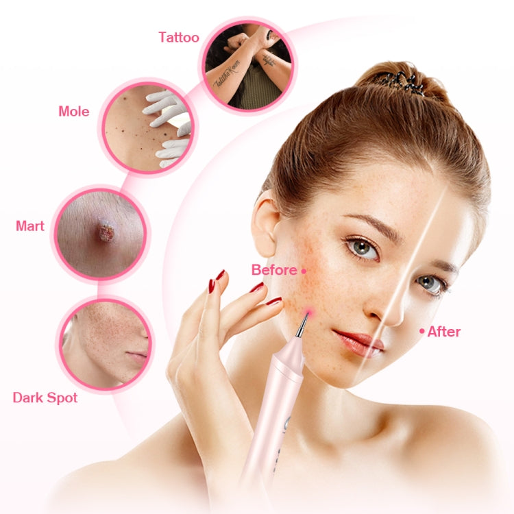 K-SKIN KD306 Laser Spotting Machine Plasma Pen Dark Eyelash Remover for Facial Spasm Removal Tattoo Skin Care(White) - free shipping - PMC Jewellery - Order now!