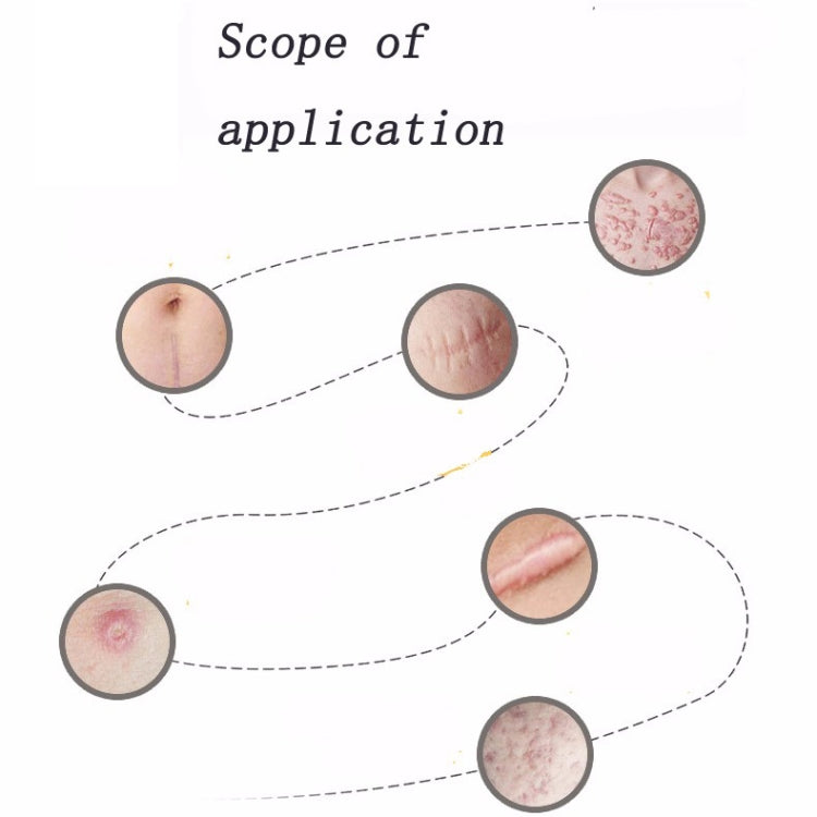 Organic silicone Gel Scar Therapy Patch be Washed and Reused - free shipping - PMC Jewellery - Order now!