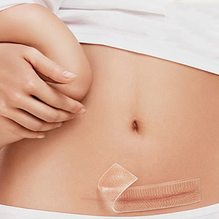 Organic silicone Gel Scar Therapy Patch be Washed and Reused - free shipping - PMC Jewellery - Order now!