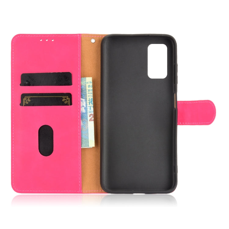 For Blackview A90 Solid Color Skin Feel Magnetic Buckle Horizontal Flip Calf Texture PU Leather Case with Holder & Card Slots & Wallet(Rose Red) - free shipping - PMC TechLife - Order now!