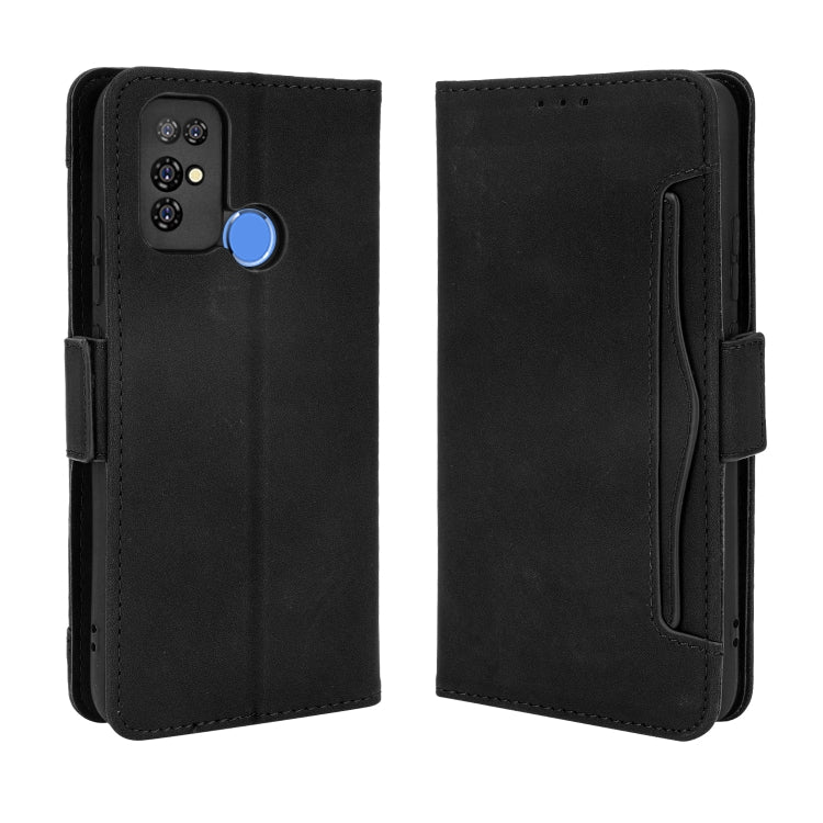 For Doogee X96 Pro Skin Feel Calf Pattern Horizontal Flip Leather Case with Holder & Card Slots & Photo Frame(Black)
