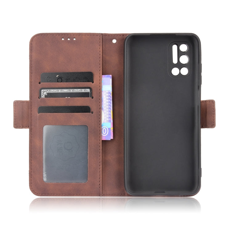 For Doogee N40 Pro Skin Feel Calf Pattern Horizontal Flip Leather Case with Holder & Card Slots & Photo Frame(Brown)