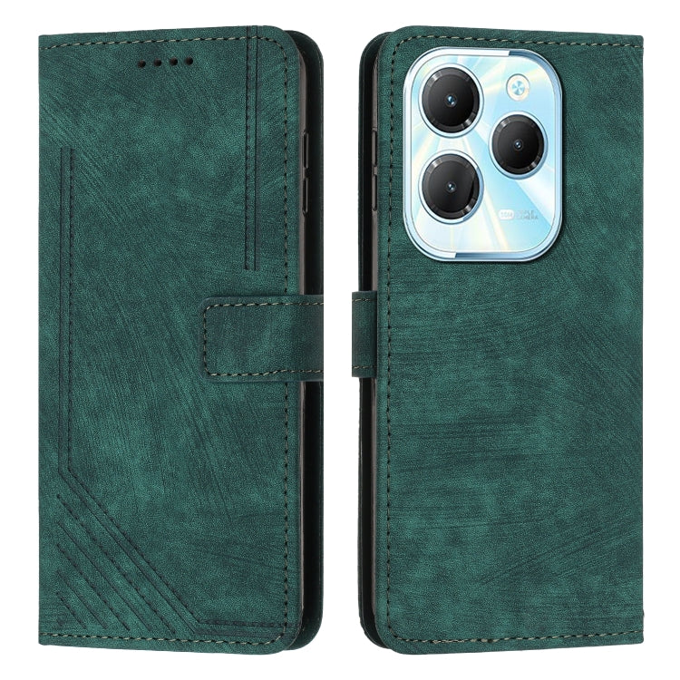 For Infinix Hot 40 / 40 Pro Skin Feel Stripe Pattern Leather Phone Case with Lanyard(Green) - Infinix Cases by PMC TechLife | Online Shopping South Africa | PMC TechLife | Buy Now Pay Later Mobicred