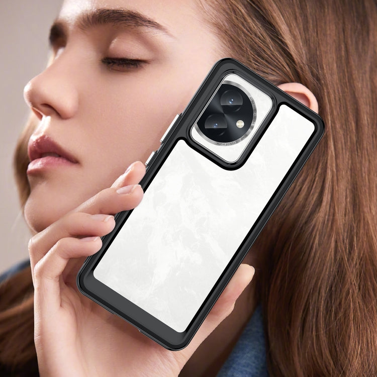 For Honor 100 Colorful Series Acrylic Hybrid TPU Phone Case(Black) - Honor Cases by PMC TechLife | Online Shopping South Africa | PMC TechLife | Buy Now Pay Later Mobicred
