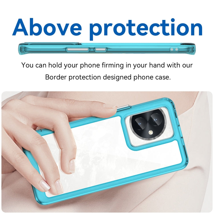 For Honor 100 Colorful Series Acrylic Hybrid TPU Phone Case(Transparent Blue)