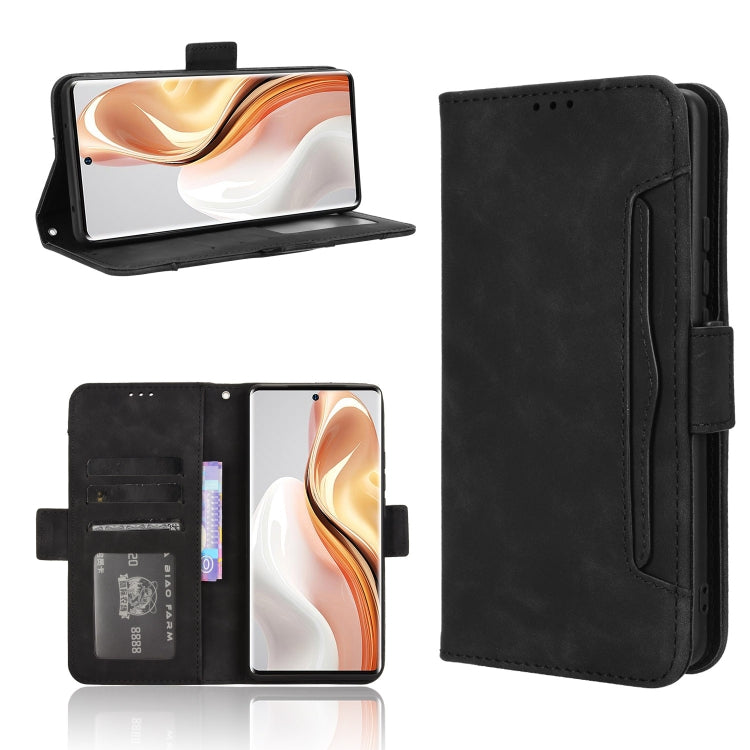 For Ulefone Note 17 Pro Skin Feel Calf Texture Card Slots Leather Phone Case(Black) - Ulefone Cases by PMC Jewellery | Online Shopping South Africa | PMC Jewellery | Buy Now Pay Later Mobicred