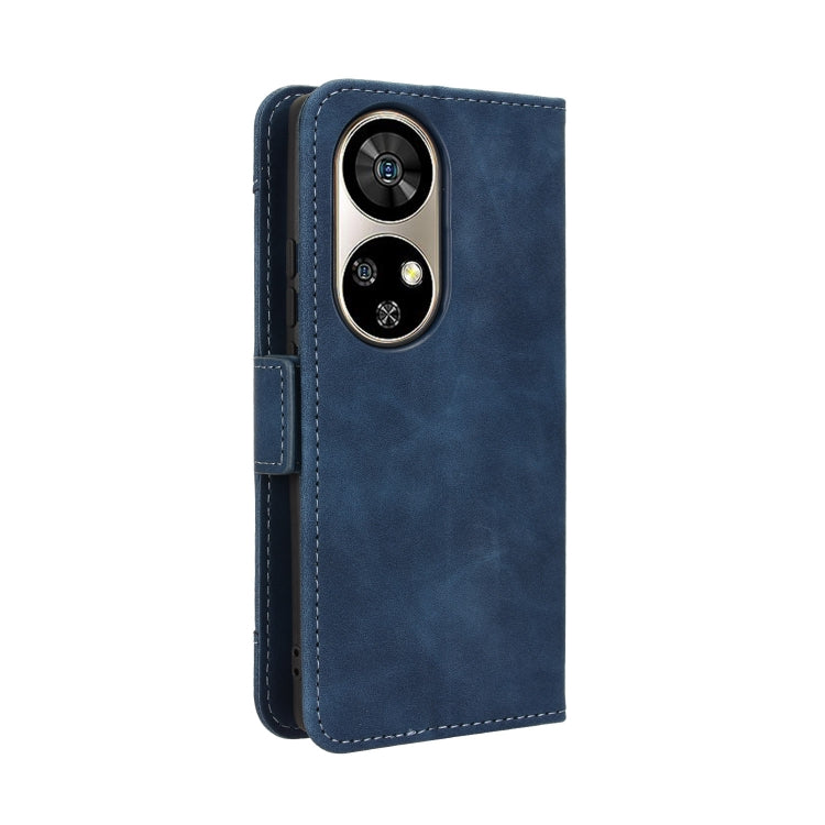 For Ulefone Note 17 Pro Skin Feel Calf Texture Card Slots Leather Phone Case(Blue) - Ulefone Cases by PMC Jewellery | Online Shopping South Africa | PMC Jewellery | Buy Now Pay Later Mobicred