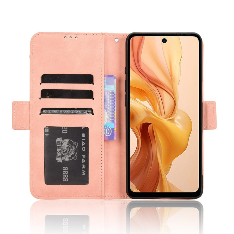 For Ulefone Note 18 Ultra Skin Feel Calf Texture Card Slots Leather Phone Case(Pink) - Ulefone Cases by PMC Jewellery | Online Shopping South Africa | PMC Jewellery | Buy Now Pay Later Mobicred