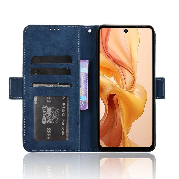 For Ulefone Note 18 Ultra Skin Feel Calf Texture Card Slots Leather Phone Case(Blue) - Ulefone Cases by PMC Jewellery | Online Shopping South Africa | PMC Jewellery | Buy Now Pay Later Mobicred
