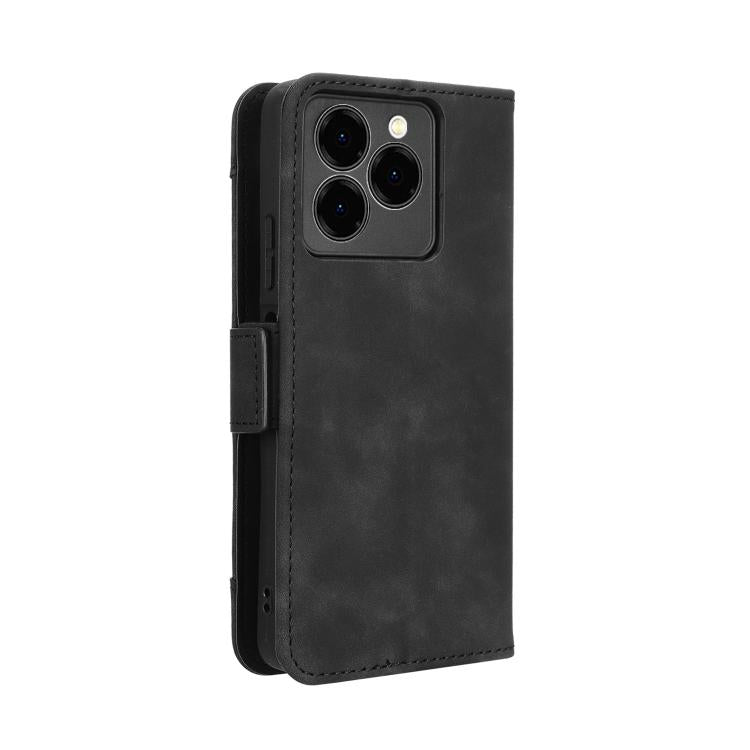 For Ulefone Note 20 Pro Skin Feel Calf Texture Card Slots Leather Phone Case(Black) - Ulefone Cases by PMC TechLife | Online Shopping South Africa | PMC TechLife | Buy Now Pay Later Mobicred
