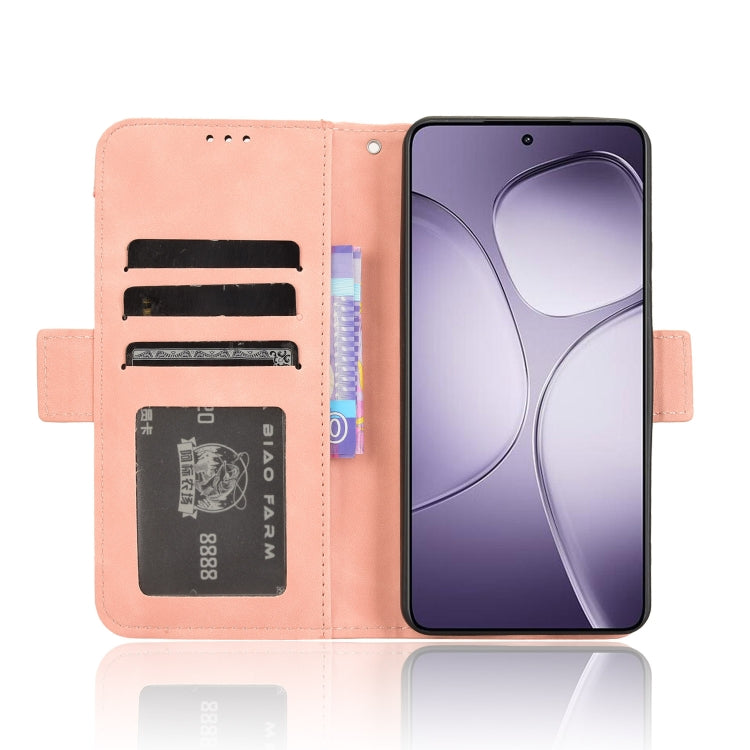 For Redmi K70 Ultra Skin Feel Calf Texture Card Slots Leather Phone Case(Pink)