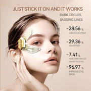 XPRE425 3.7V 80mAh EMS Eye Beauty Instrument(Gold)