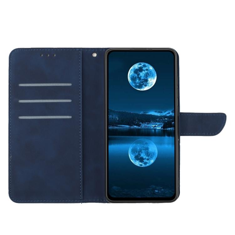 For Tecno Spark 40 Pro+ 4G Stitching Embossed Leather Phone Case(Blue)