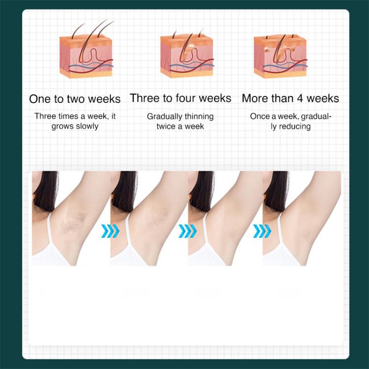 FY-B501 Laser Hair Removal Device Home Electric IPL Intense Pulse Hair Remover, US Plug(Dark Green) - free shipping - PMC TechLife - Order now!