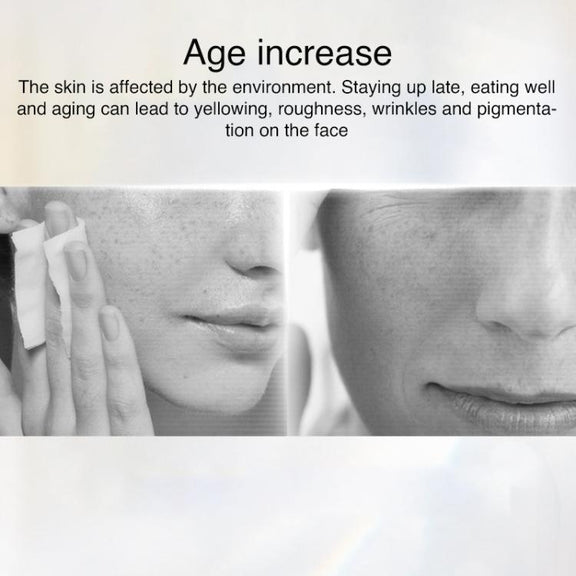 AF-101 Home Milk Light DPL Freezing Point Photon Skin Rejuvenation Device, US Plug(Black)