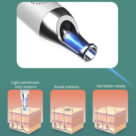 AA-A401 Portable Laser Beauty Instrument Mole Removal Freckle Removal Beauty Laser Pen, Specification:Red Light Plug-in