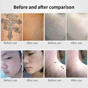 AA-A401 Portable Laser Beauty Instrument Mole Removal Freckle Removal Beauty Laser Pen, Specification:Blue Light Plug-in