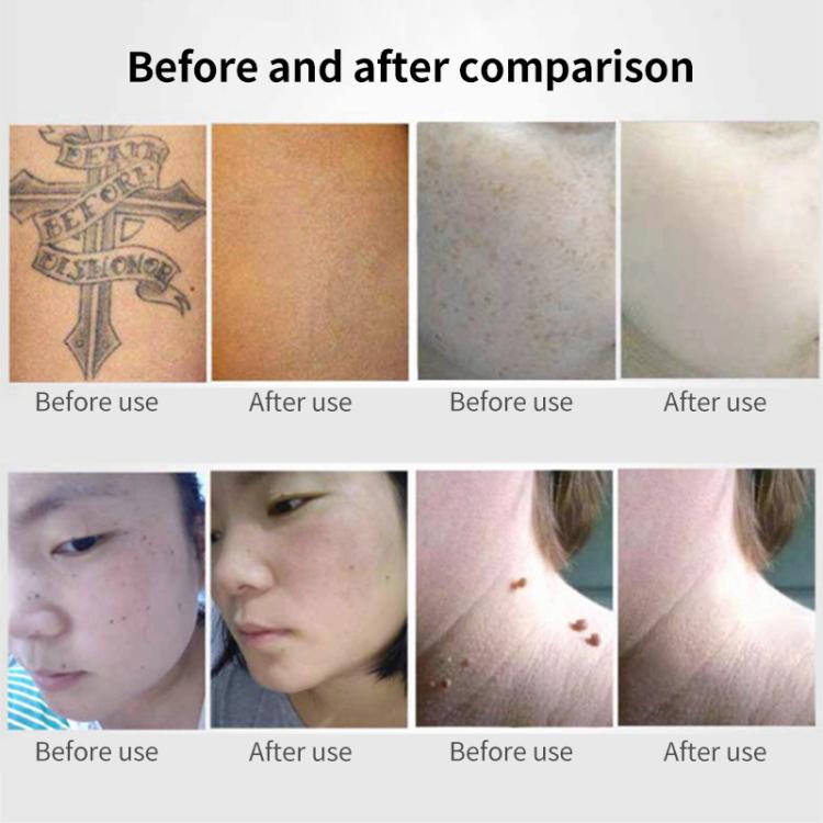 AA-A401 Portable Laser Beauty Instrument Mole Removal Freckle Removal Beauty Laser Pen, Specification:Red Light Plug-in
