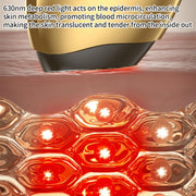 WG-SP-MS1135 EMS Collagen Cannon Essence Introducer Photon Skin Rejuvenation RF Beauty Device(Gold)