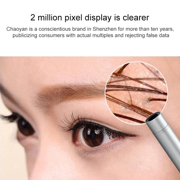 Supereyes B003+ Digital Electronic Vaginal Cervical Endoscope Private Inspection Instrument Self-inspection Mirror - free shipping - PMC Jewellery - Order now!