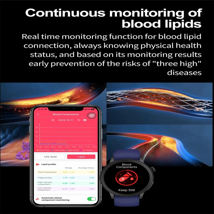 ET470 1.39 inch Color Screen Smart Watch Silicone Strap, Support Bluetooth Call / ECG(Pink) - free shipping - PMC TechLife - Order now!