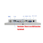 ZGYNK TB1016 10 Inch LCD Screen Ear Picking Equipment High-Definition Video Storage Display, US Plug, Specification: Ear Picking Video Version
