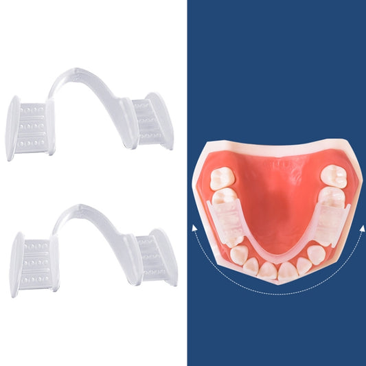 Y-Kelin Orthodontic Appliance Silicone Simulation Braces Anti-Molar Braces For Night(Transparent) - free shipping - PMC Jewellery - Order now!
