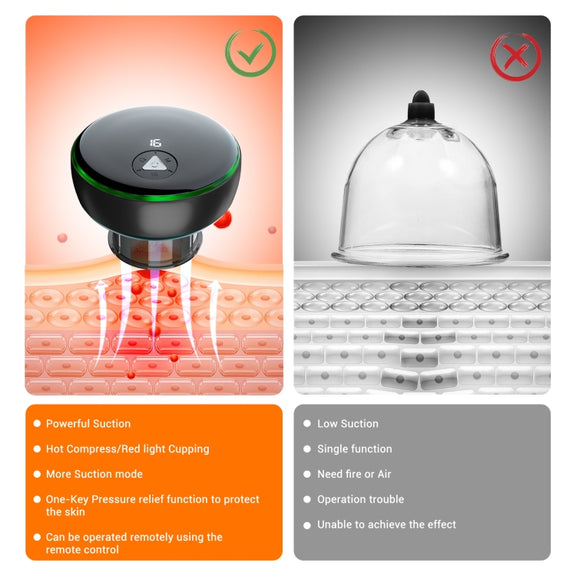 Intelligent Cupper With Breathing Light Electric Heated Scraping Instrument Meridian Unblocking Massage Instrument(Red)