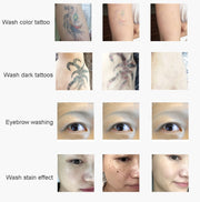 Laser Tattoo Removal Machine Non-invasive Eyebrow Washing Beauty Equipment(UK Plug)