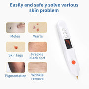 Spot Mole Pen Spot Removal Instrument Home Beauty Instrument, Spec: Plug-in Model EU(White)