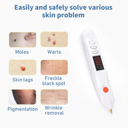 Spot Mole Pen Spot Removal Instrument Home Beauty Instrument, Spec: US  Plug -in Model(White) - free shipping - PMC Jewellery - Order now!