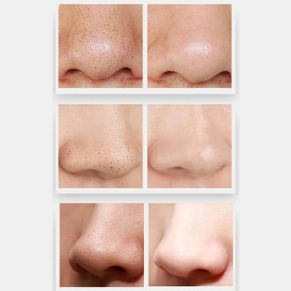 ZLY-018 Household Electric Blackhead Suction Device Pore Cleaning and Beauty Equipment(Standard) - free shipping - PMC Jewellery - Order now!