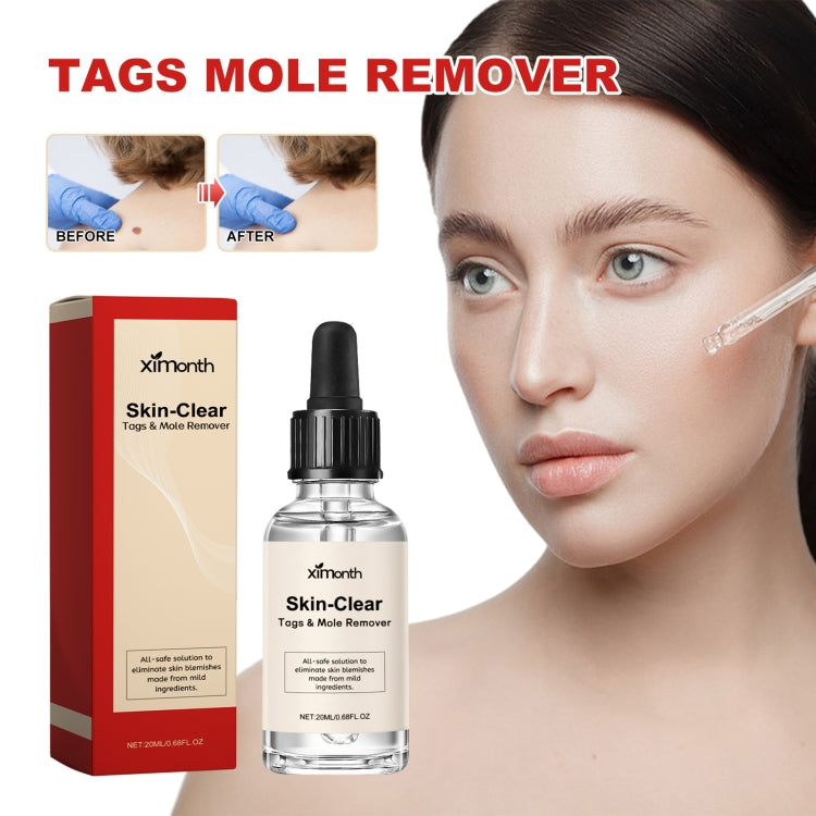 Ximonth 20ml/Bottle Anti Mole And Wart Liquid Dark Spot Tag Remover Skin Essence - free shipping - PMC Jewellery - Order now!