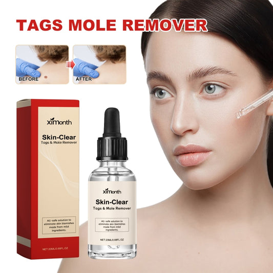 Ximonth 20ml/Bottle Anti Mole And Wart Liquid Dark Spot Tag Remover Skin Essence - free shipping - PMC Jewellery - Order now!