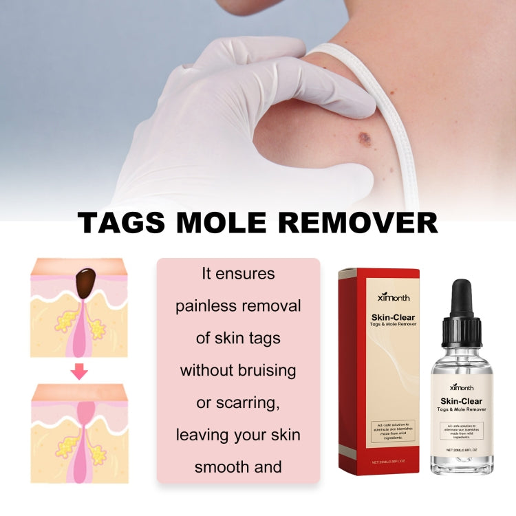 Ximonth 20ml/Bottle Anti Mole And Wart Liquid Dark Spot Tag Remover Skin Essence - free shipping - PMC Jewellery - Order now!