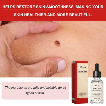 Ximonth 20ml/Bottle Anti Mole And Wart Liquid Dark Spot Tag Remover Skin Essence - free shipping - PMC Jewellery - Order now!