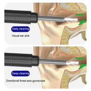 Household Visual Ear Excavator High-Definition Ear Wax Removal Picking Stick(Black)