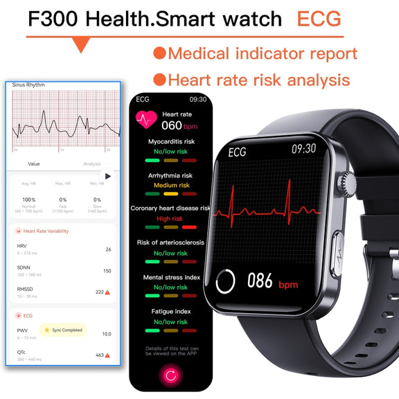 F300  2.1-Inch Screen Smart Watch Supports Bluetooth Calls/ECG/Blood Composition Analysis/50+ Sports Modes, Color: Black Milan