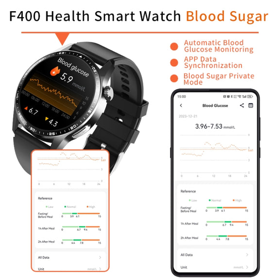 F400  1.55 Inch Screen Smart Watch Support ECG/ Blood Oxygen / Blood Sugar / 150+ Sports Mode, Color: Black Silicone