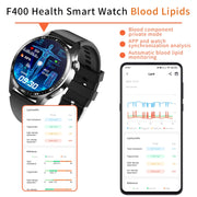F400  1.55 Inch Screen Smart Watch Support ECG/ Blood Oxygen / Blood Sugar / 150+ Sports Mode, Color: Black Silicone