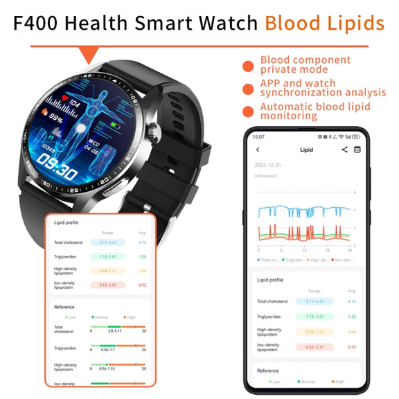 F400  1.55 Inch Screen Smart Watch Support ECG/ Blood Oxygen / Blood Sugar / 150+ Sports Mode, Color: Black Silicone