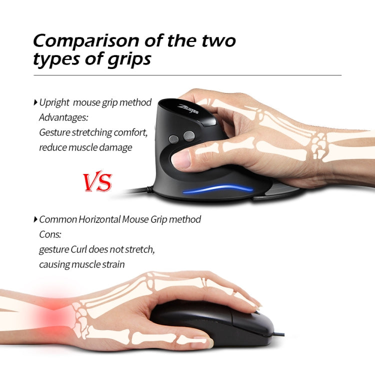 ZELOTES T30 6-keys Vertical Grip Detachable Ergonomic Wired Mouse(7-color Breathing Light) - free shipping - PMC Jewellery - Order now!