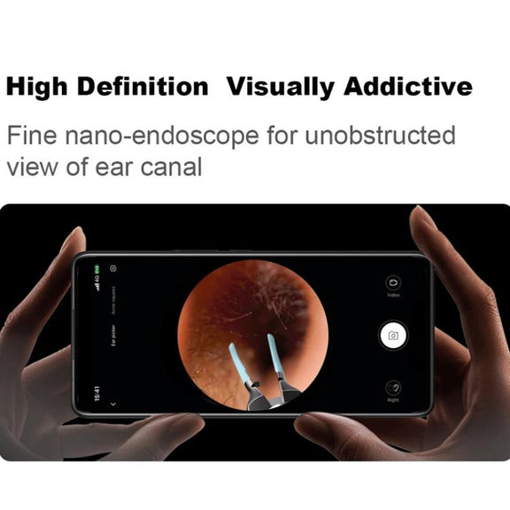 Bebird Note5 Pro Visual Ear Scoop Ear Picking Tool Cleaning Set(White)