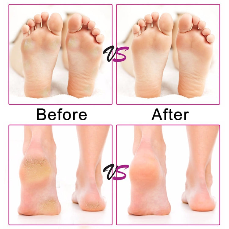 Electric Foot File Speed Adjustable Sandpaper Discs Callus Remover Pedicure Fast Remove Feet Hard Cracked Dry Dead Skin Tool, Plug Type:US plug(Black) - free shipping - PMC TechLife - Order now!
