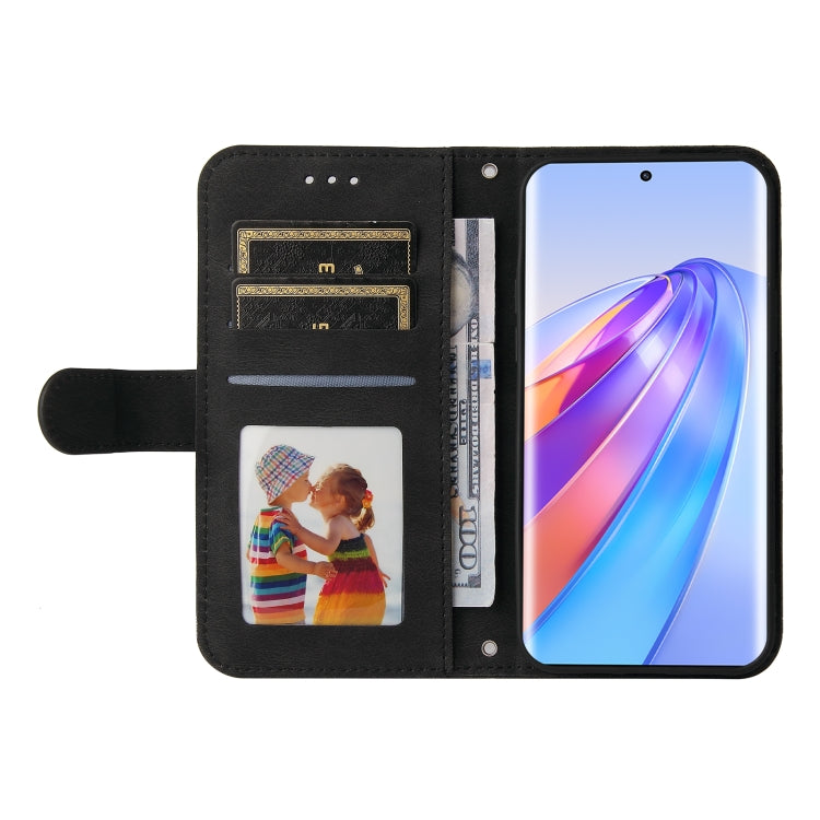 For Honor X9a/X40 5G/Magic5 Lite Skin Feel Life Tree Metal Button Leather Phone Case(Black) - Honor Cases by PMC TechLife | Online Shopping South Africa | PMC TechLife | Buy Now Pay Later Mobicred