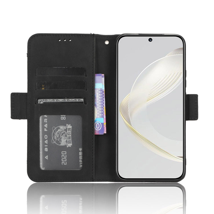 For Huawei nova 11 Skin Feel Calf Texture Card Slots Leather Phone Case(Black)